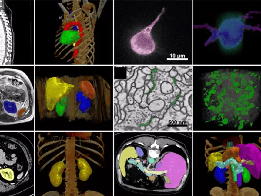 Human Radiome Project "ChatGPT for Medical Professionals" 